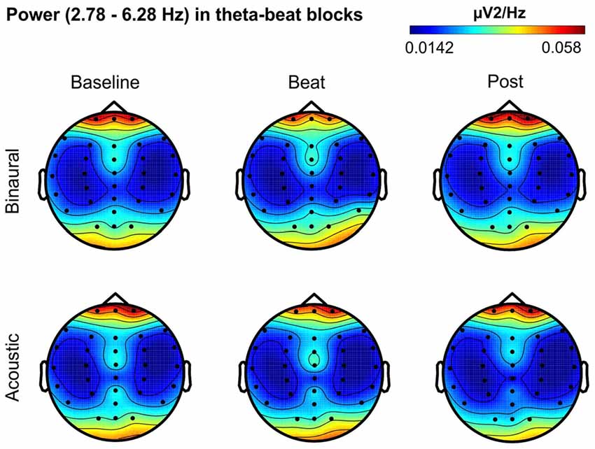 Can You Listen to Binaural Beats While Meditating?